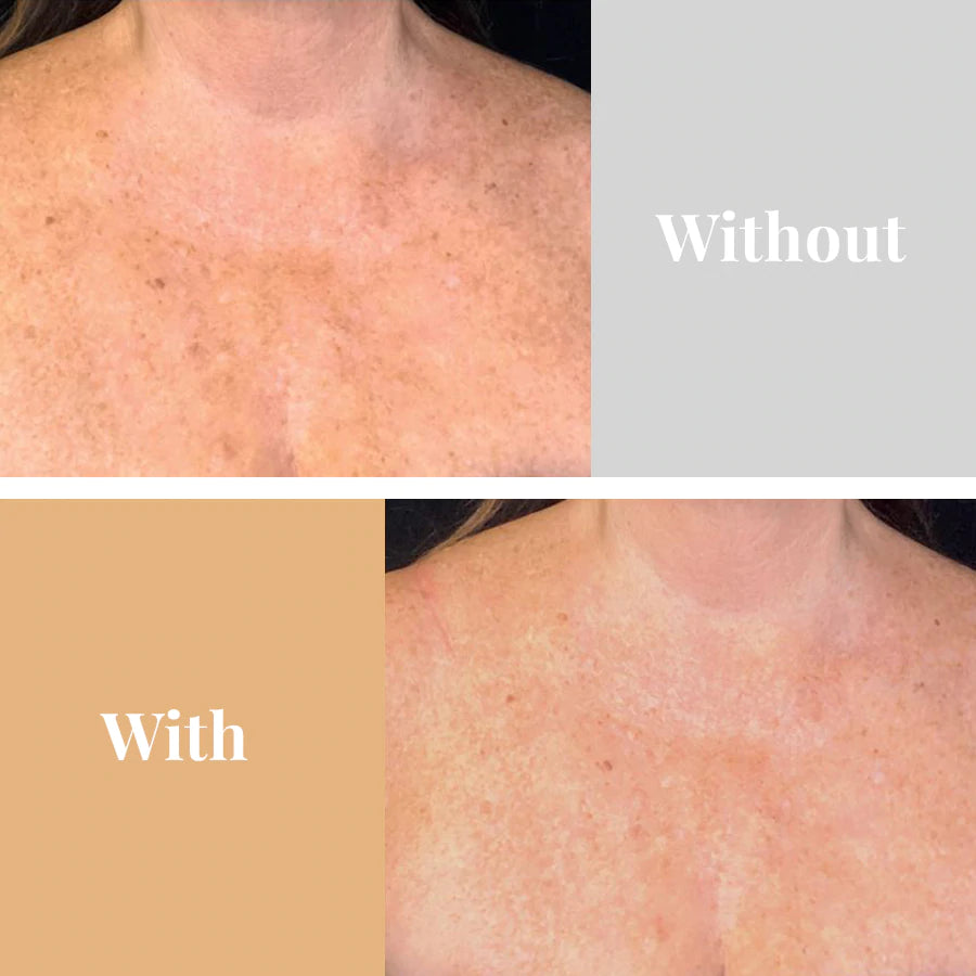 Omnilux ContourTM Neck & Décolleté