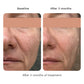 Volume Cream