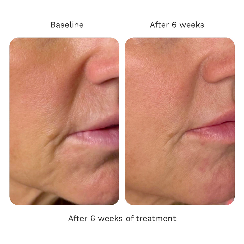 Volume Cream