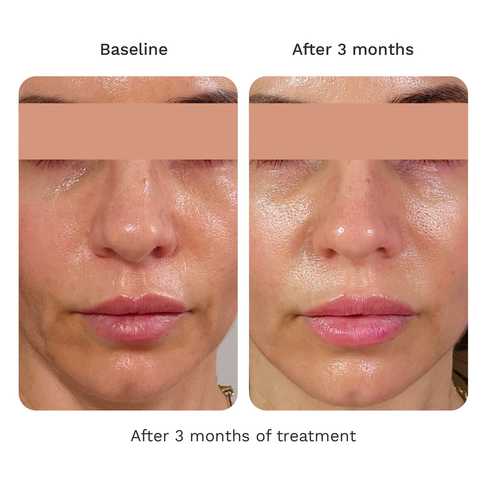 Volume Cream