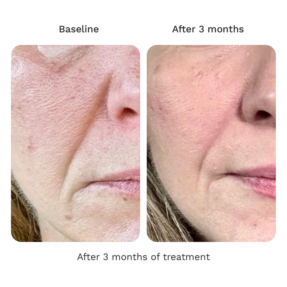 Volume Cream