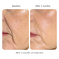 Volume Cream