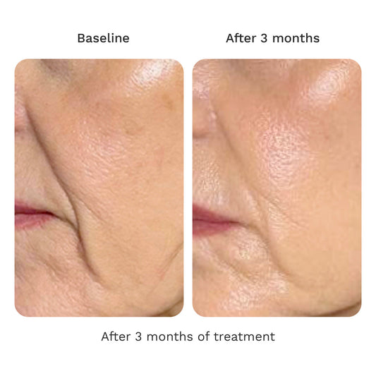 Volume Cream