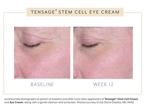 Tensage Stem Cell Eye Cream